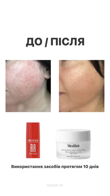 Результати &mdash; Фото 1