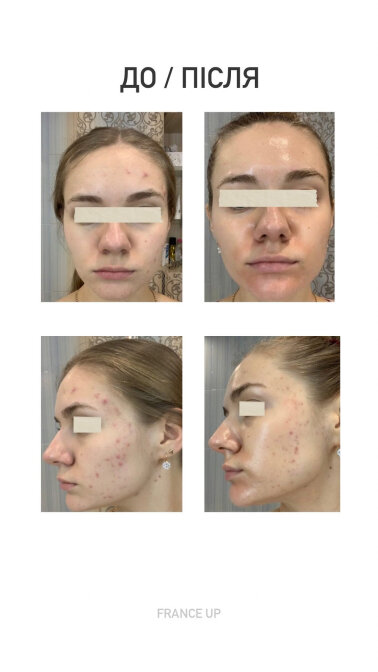 Результати &mdash; Фото 4