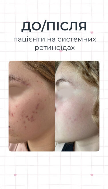 Результати &mdash; Фото 6