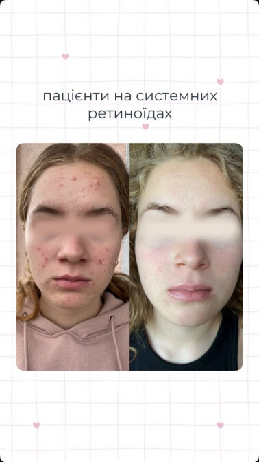 Результати &mdash; Фото 7