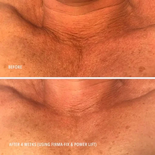 HydroPeptide Firm-A-Fix Nectar 50ml Ліфтинг-сироватка для шиї та декольте &mdash; Фото 3