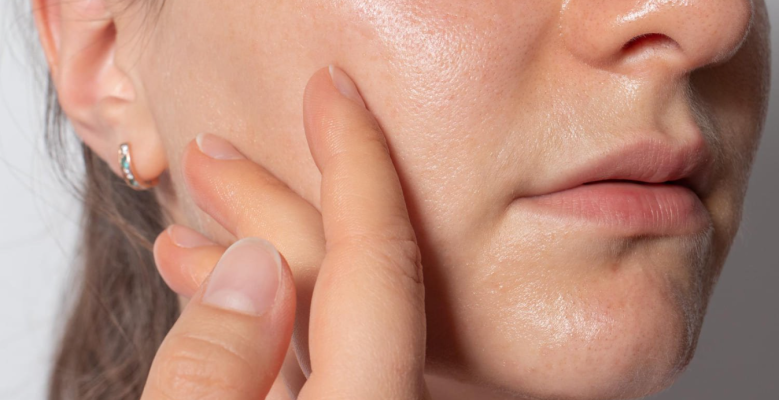 Розширені пори: проблема чи норма?